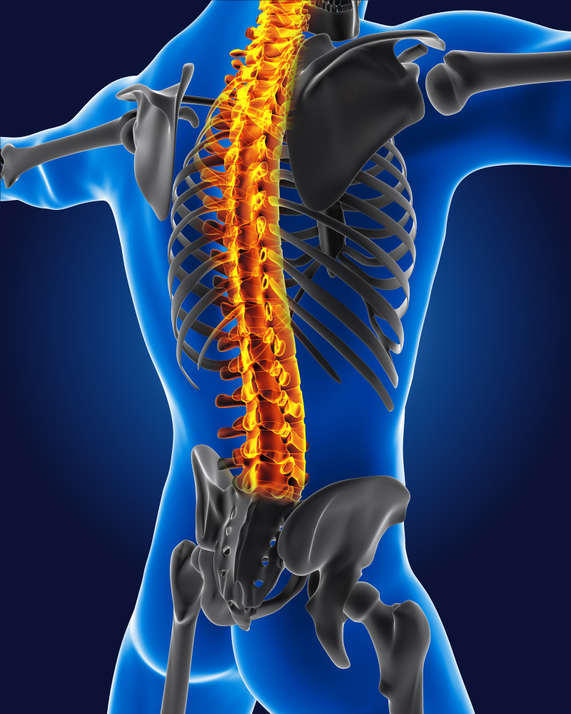 Get a chiropractic posture correction in Union City NJ